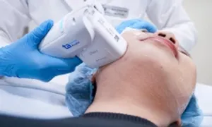 Công nghệ HIFU có thể xóa nếp nhăn, nọng cằm không?